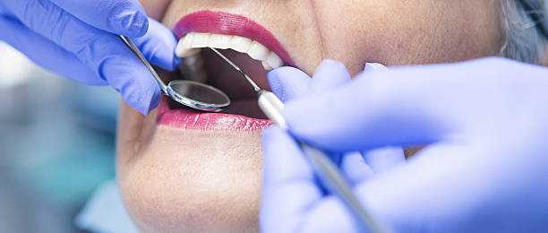 Best Emergency Dental Care for Broken or Chipped Teeth in Chena Ridge, AK